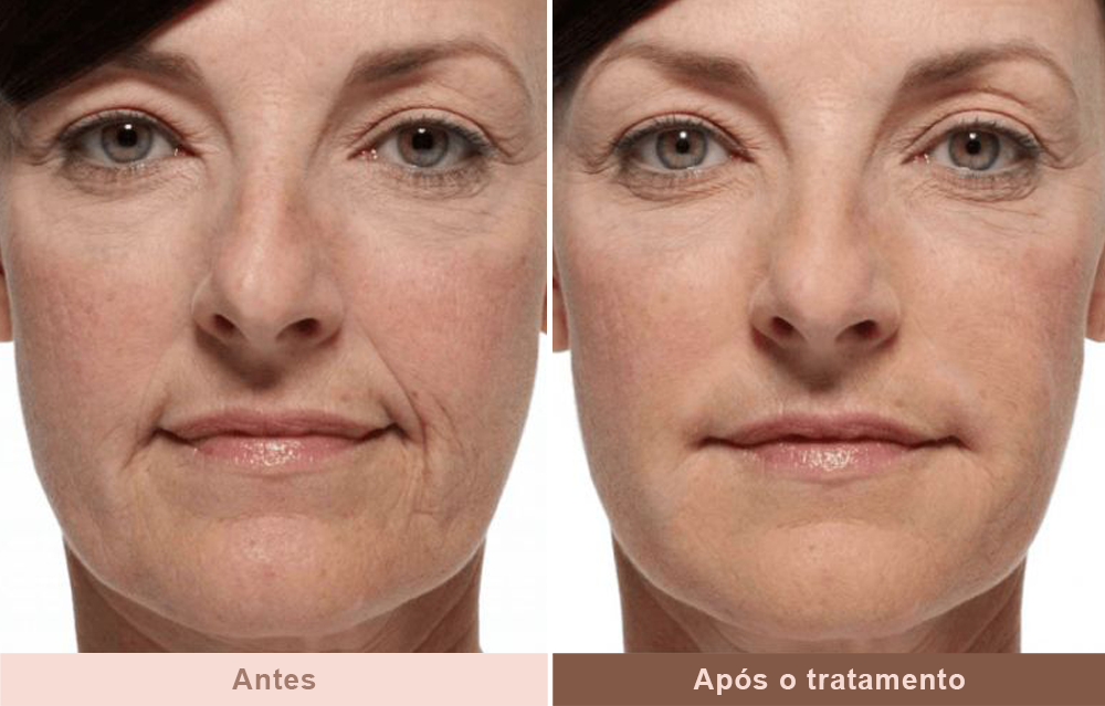 Antes-e-Depois-3