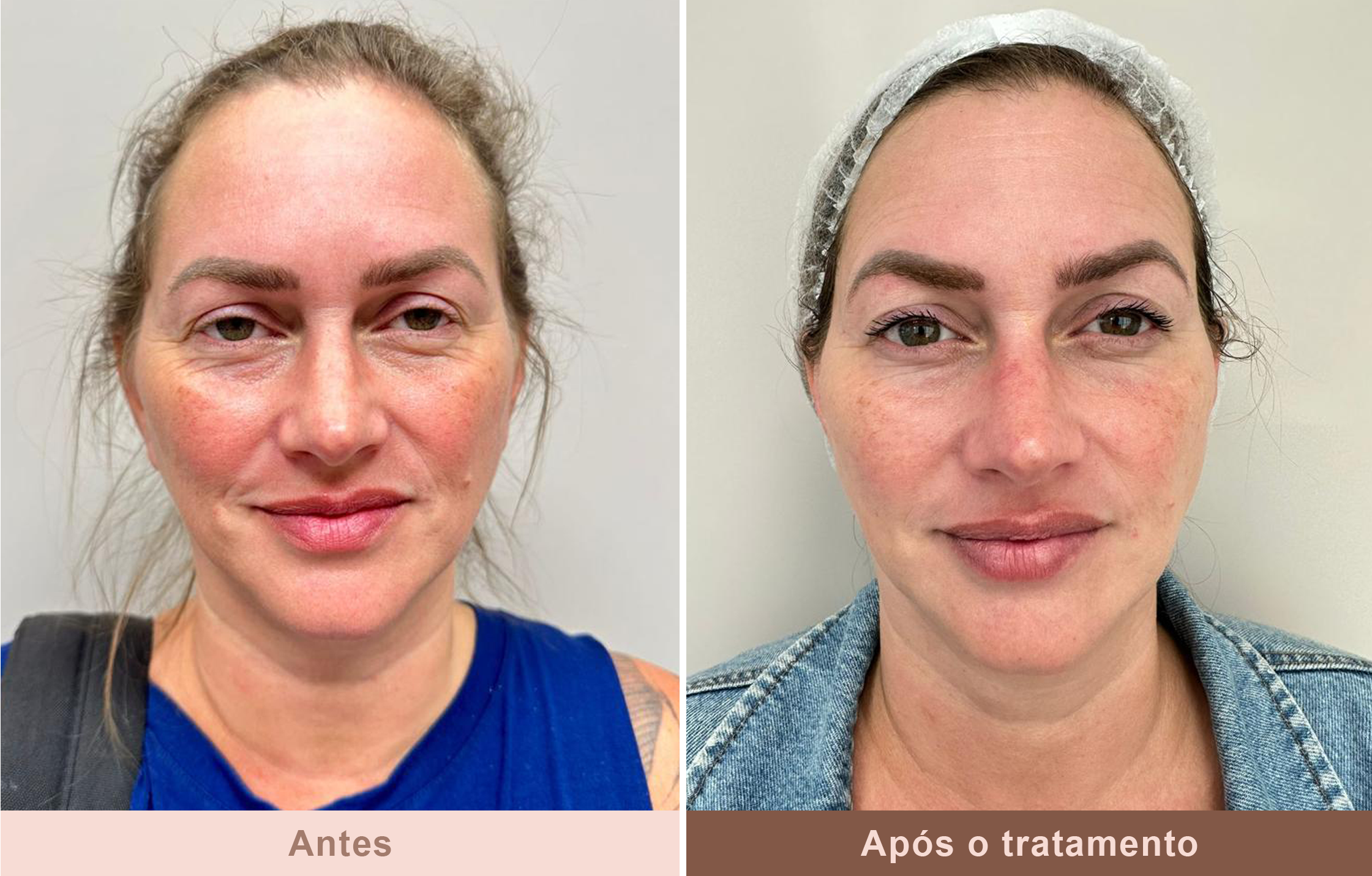 Antes-e-Depois-2