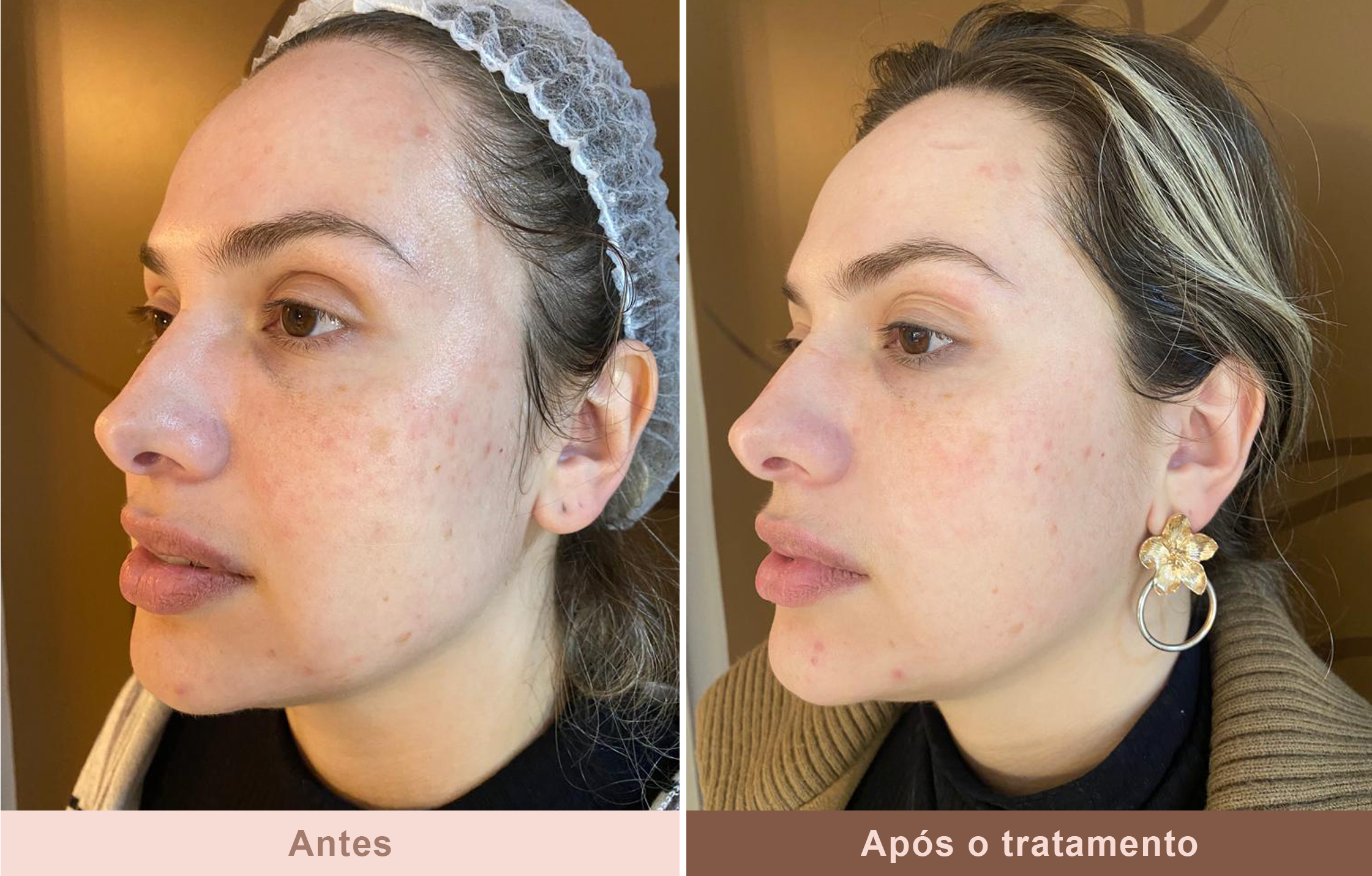 Antes-e-Depois-3